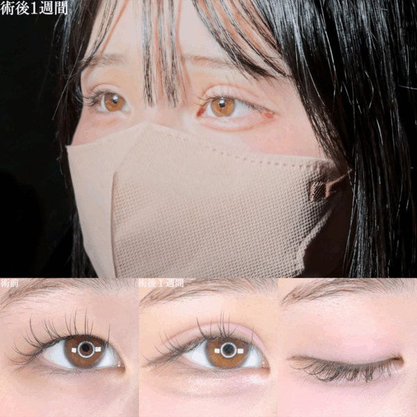No.8686の症例写真